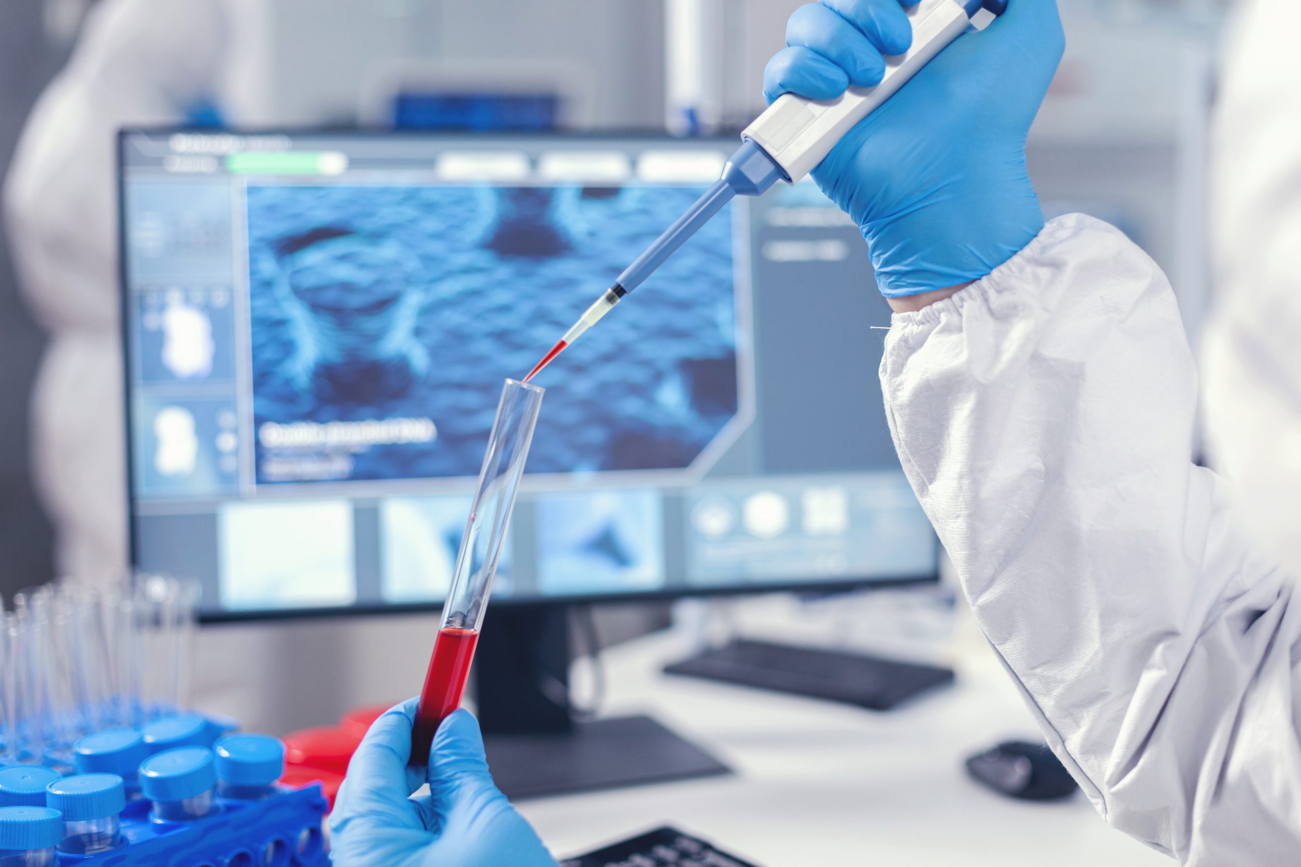 Agentic AI implementation in Diagnostics & healthcare